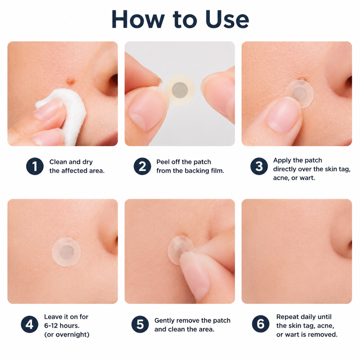 Alcuras® 2-in-1 Microneedle & Hydrocolloid Patch 🍀 | Removes Raised Moles, Acne, Flat Warts, Skin Tags, Milia & Age Spots ✨ | No Surgery Needed 🚫 | Feel Confident & Beautiful 💖 | Invisible Skin Treatment for Face & Body 🧴 | 90-Day Guarantee ✅