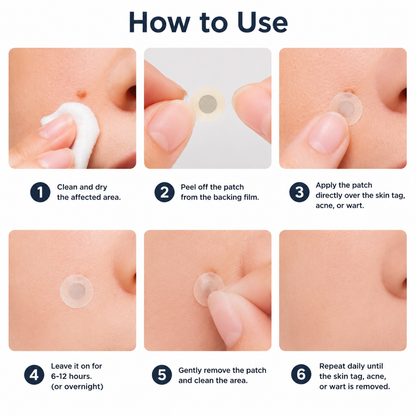 Alcuras® 2-in-1 Microneedle & Hydrocolloid Patch 🍀 | Removes Raised Moles, Acne, Flat Warts, Skin Tags, Milia & Age Spots ✨ | No Surgery Needed 🚫 | Feel Confident & Beautiful 💖 | Invisible Skin Treatment for Face & Body 🧴 | 90-Day Guarantee ✅