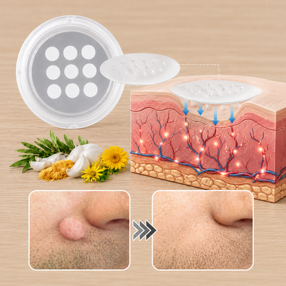 Alcuras® 2-in-1 Microneedle & Hydrocolloid Patch 🍀 | Removes Raised Moles, Acne, Flat Warts, Skin Tags, Milia & Age Spots ✨ | No Surgery Needed 🚫 | Feel Confident & Beautiful 💖 | Invisible Skin Treatment for Face & Body 🧴 | 90-Day Guarantee ✅